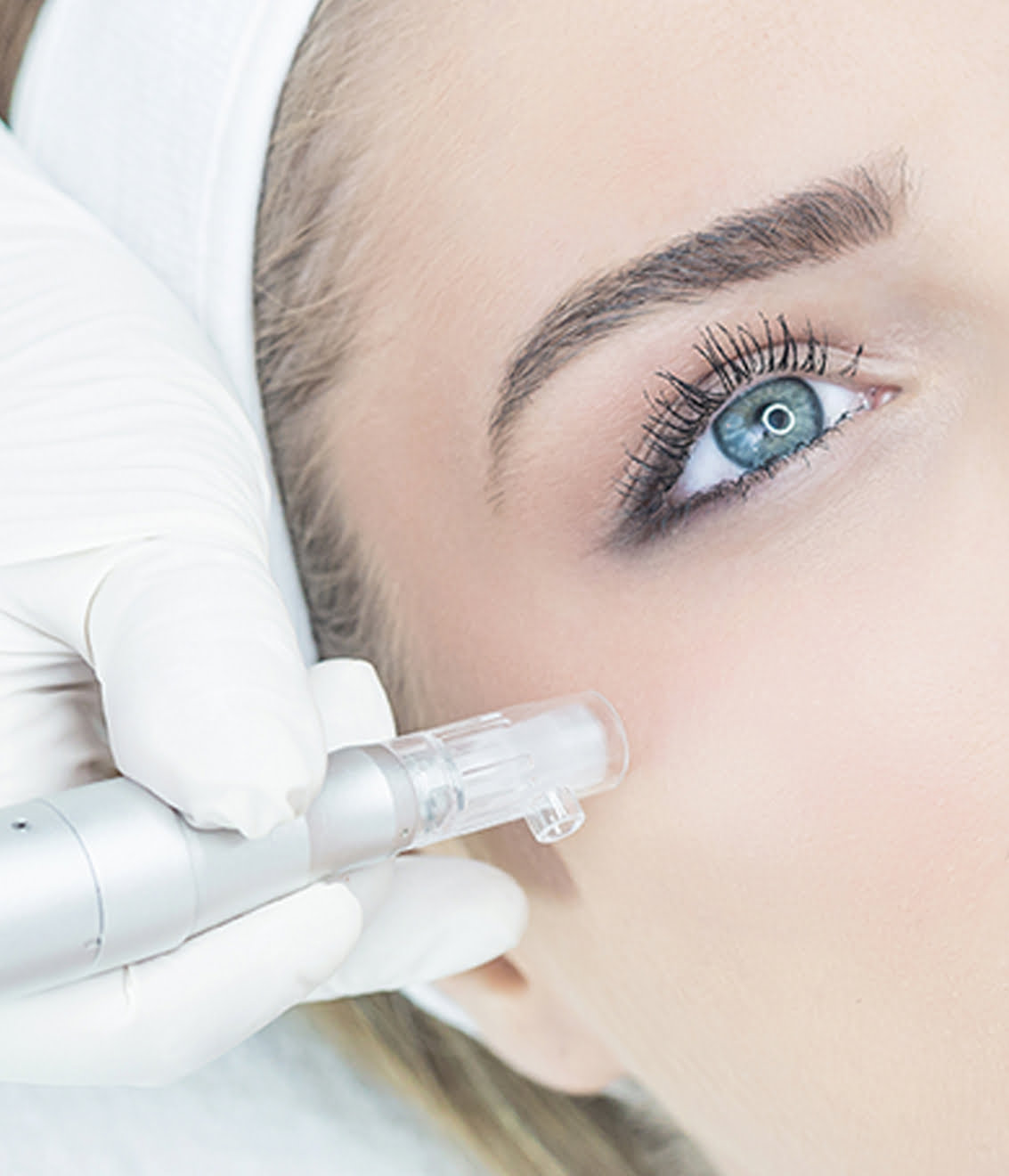 Skin Love Aesthetics is een huidverbeteringskliniek in Meppel. Verbeter je huid dankzij microneedling, fillers, injecties en permanente make-up, only the best for your skin!